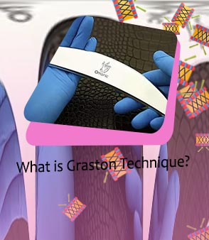 Graston technique gua sha